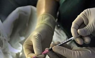 上海试管医院解读卵泡质量不好做试管用什么方案，微刺激效果好不妨试试